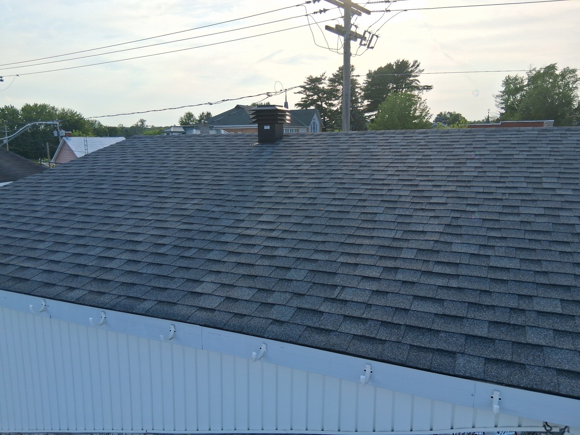 Shingles
